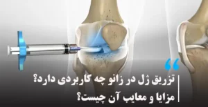 تزریق ژل در زانو چه کاربردی دارد؟ مزایا و معایب آن چیست؟