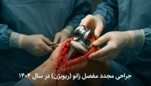 جراحی مجدد مفصل زانو (ریویژن) در سال ۱۴۰۴