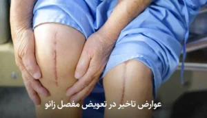 عوارض تاخیر در تعویض مفصل زانو