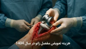 هزینه تعویض مفصل زانو در سال 1404