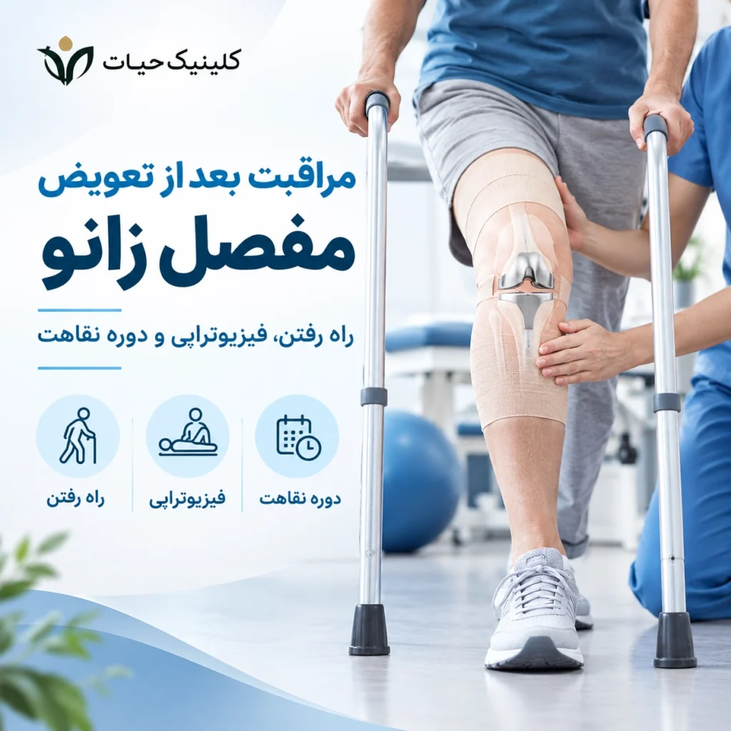 مراقبت بعد از تعویض مفصل زانو؛ راه رفتن، فیزیوتراپی و دوره نقاهت