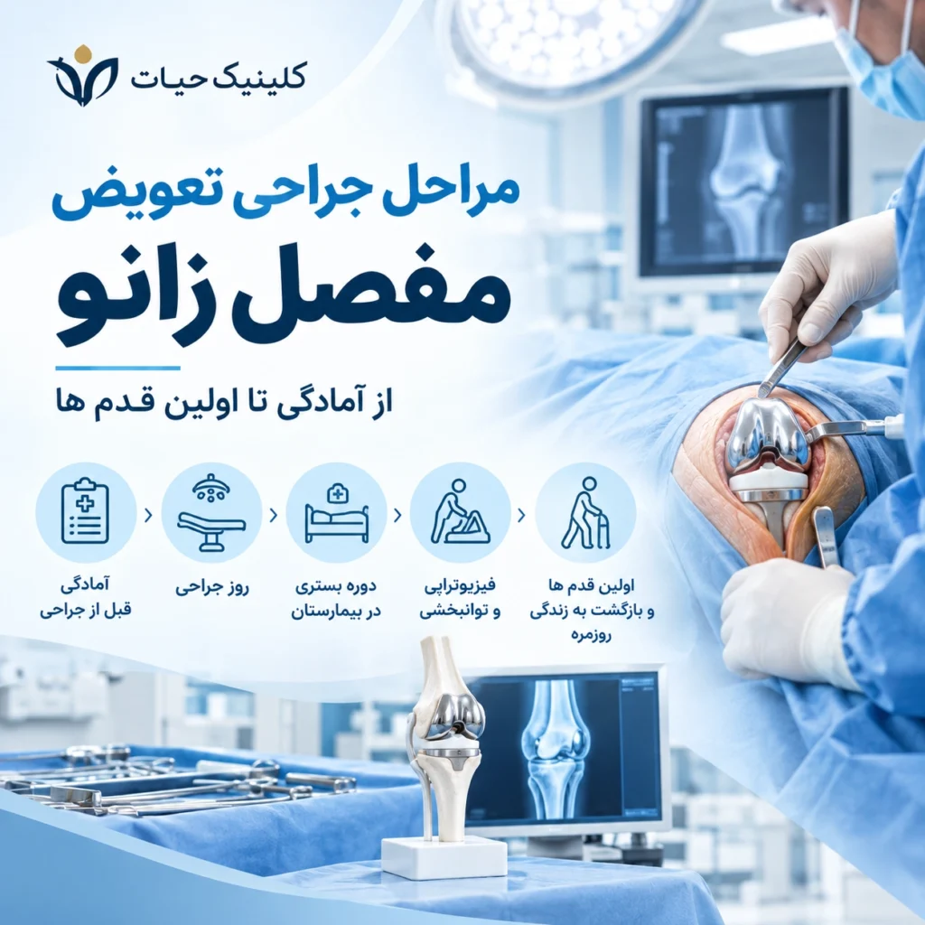 مراحل جراحی تعویض مفصل زانو؛ از آمادگی تا اولین قدم ها