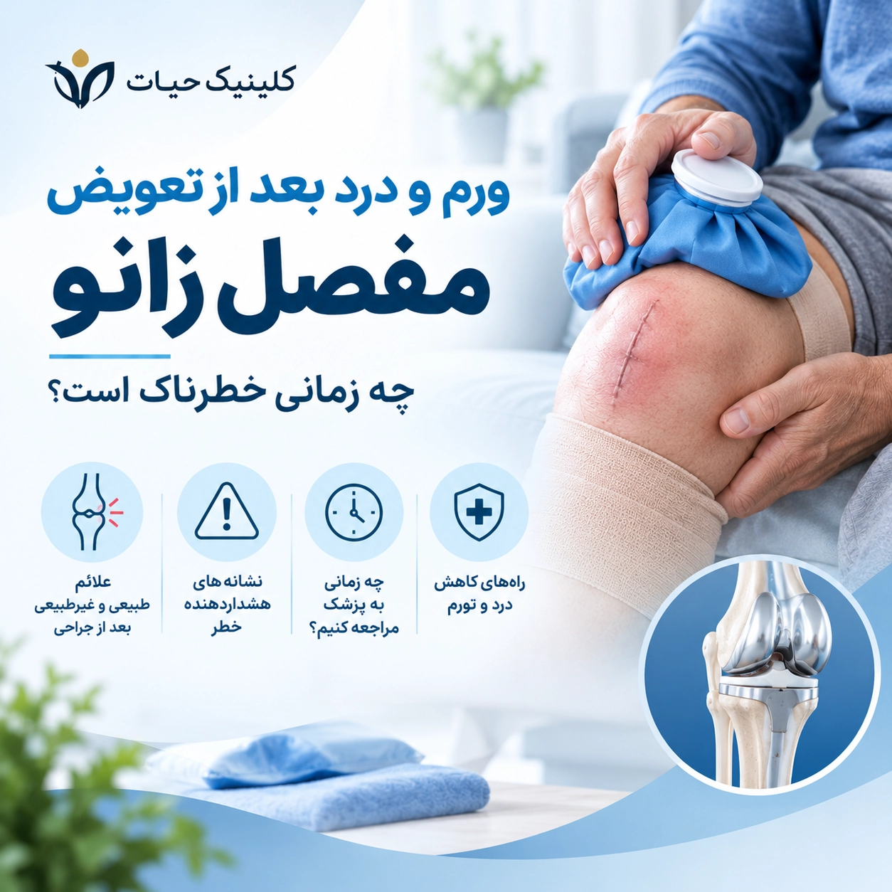 ورم و درد بعد از تعویض مفصل زانو؛ چه زمانی خطرناک است؟